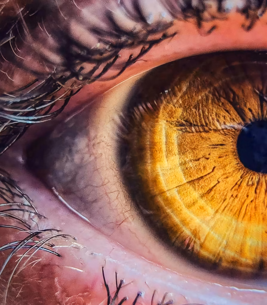 EMDR for Complex PTSD or CPTST